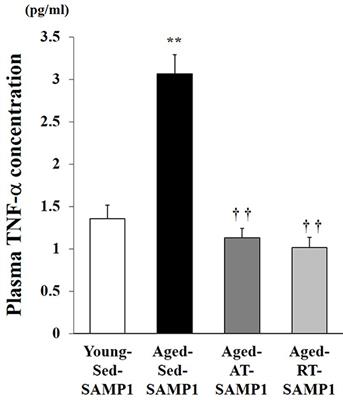 Gene Expression Profiles for Macrophage in Tissues in Response to Different Exercise Training Protocols in Senescence Mice